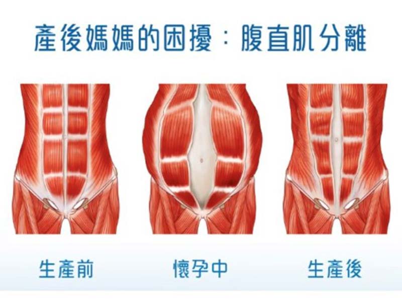 CMSlim真腹肌 你專屬的醫療級健身教練 CMSlim真腹肌 你專屬的醫療級健身教練
