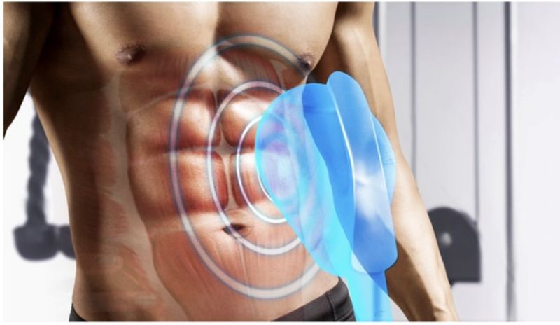 冷凍減脂是什麼？療程原理、優缺點與效果總整理