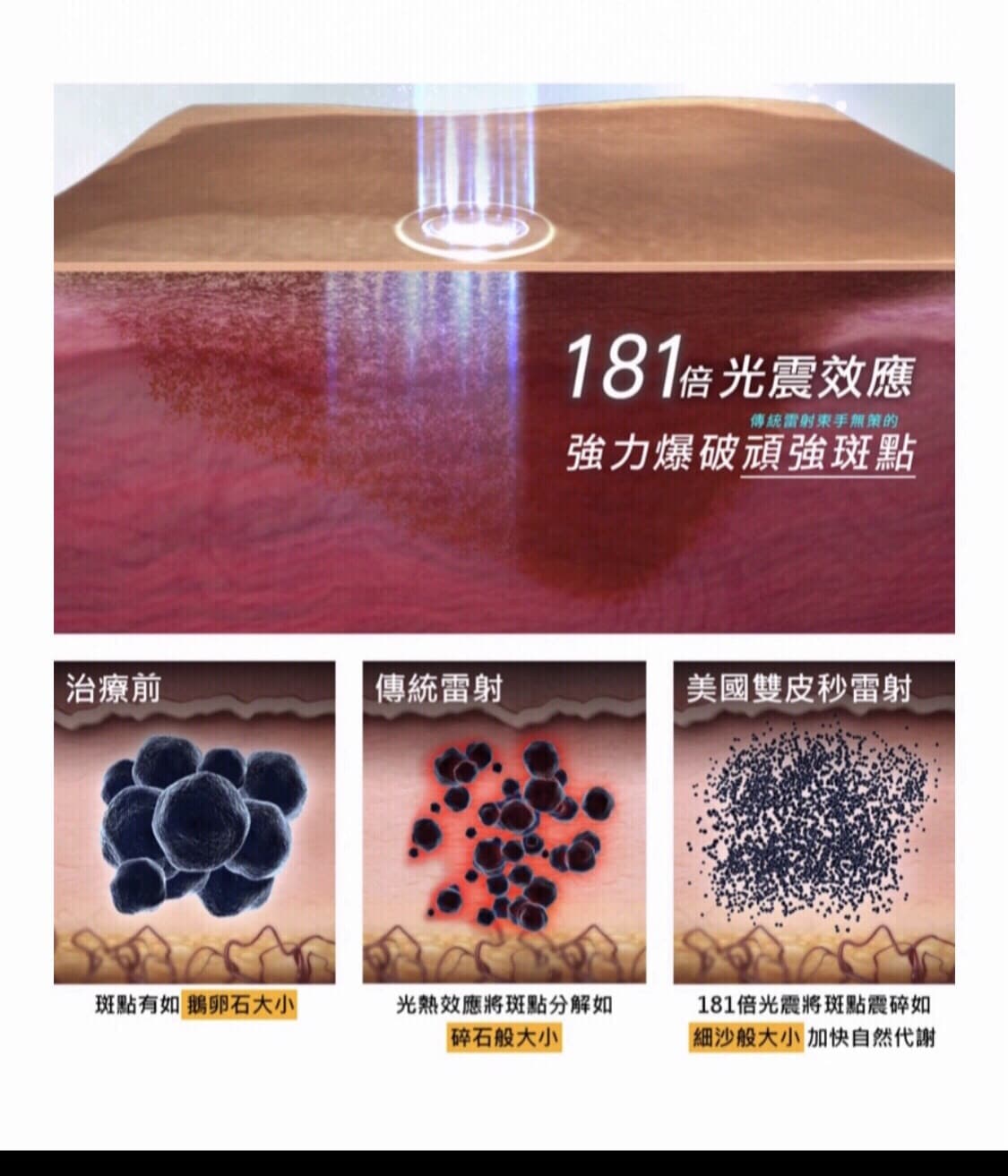 除斑術 除斑術