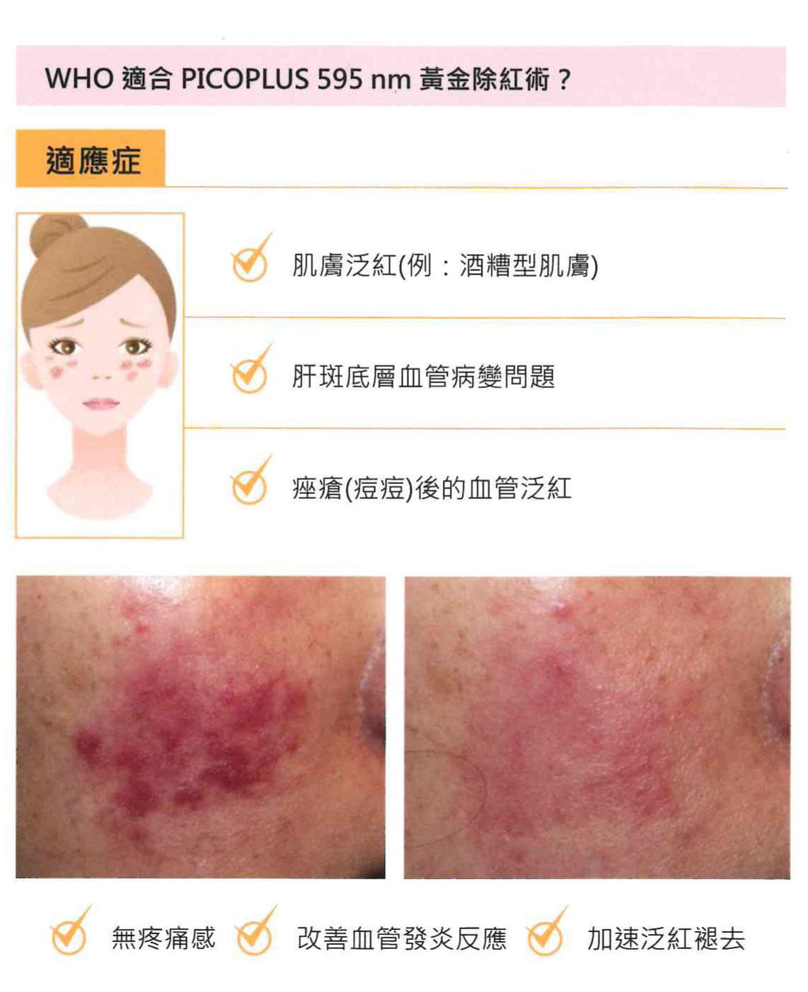 黄金595除紅術 黄金595除紅術