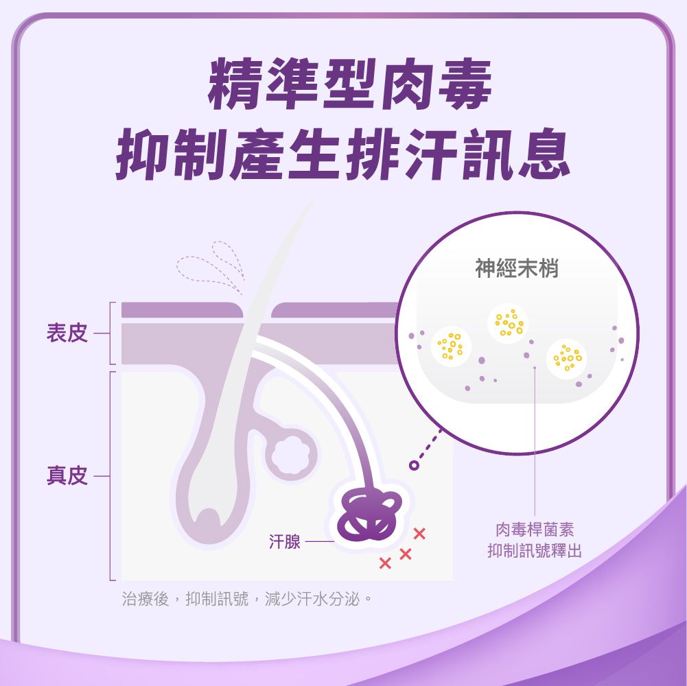精準型肉毒 精準型肉毒