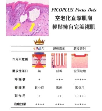 聚焦美機-改善毛孔粗大 聚焦美機-改善毛孔粗大