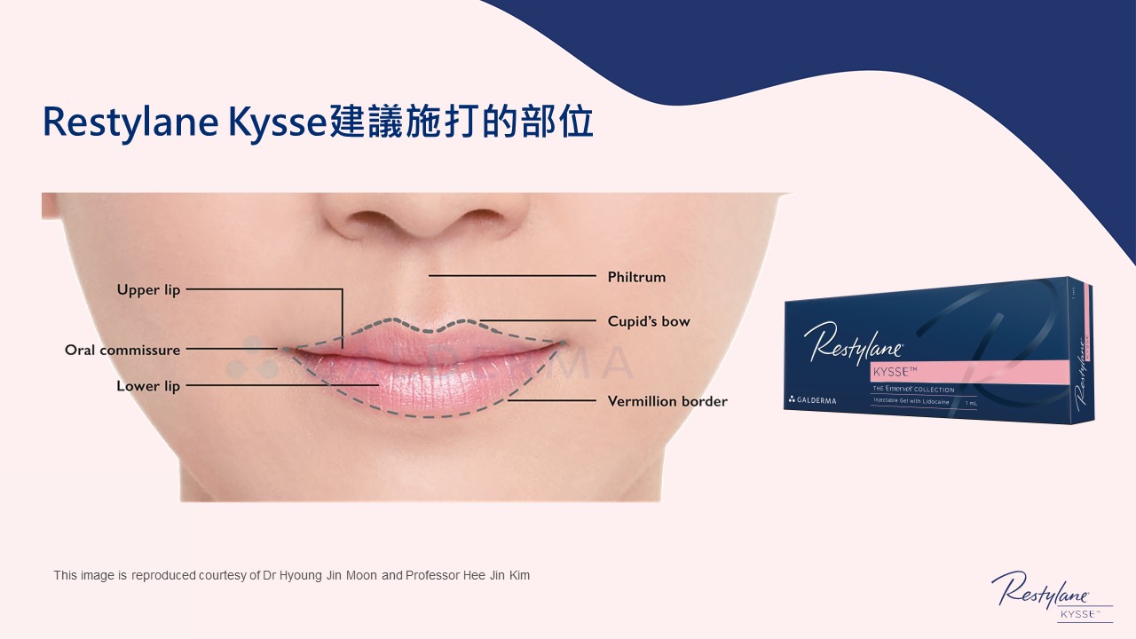 女神Kysse-漾唇K劑型