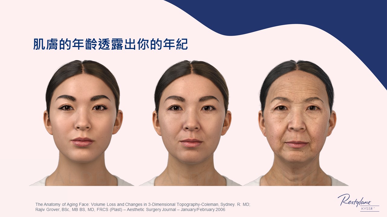 女神Kysse-漾唇K劑型