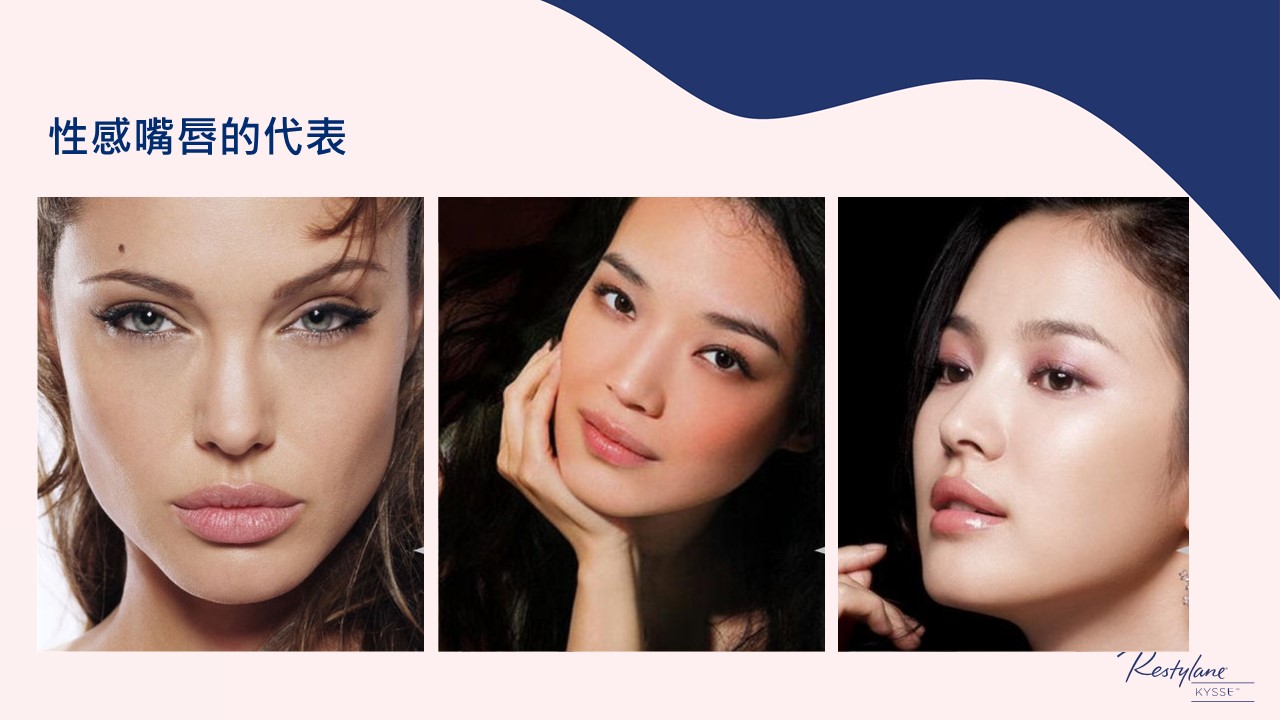 女神Kysse-漾唇K劑型