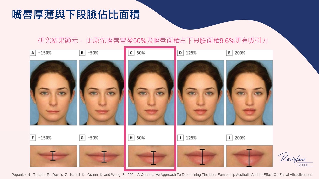 女神Kysse-漾唇K劑型