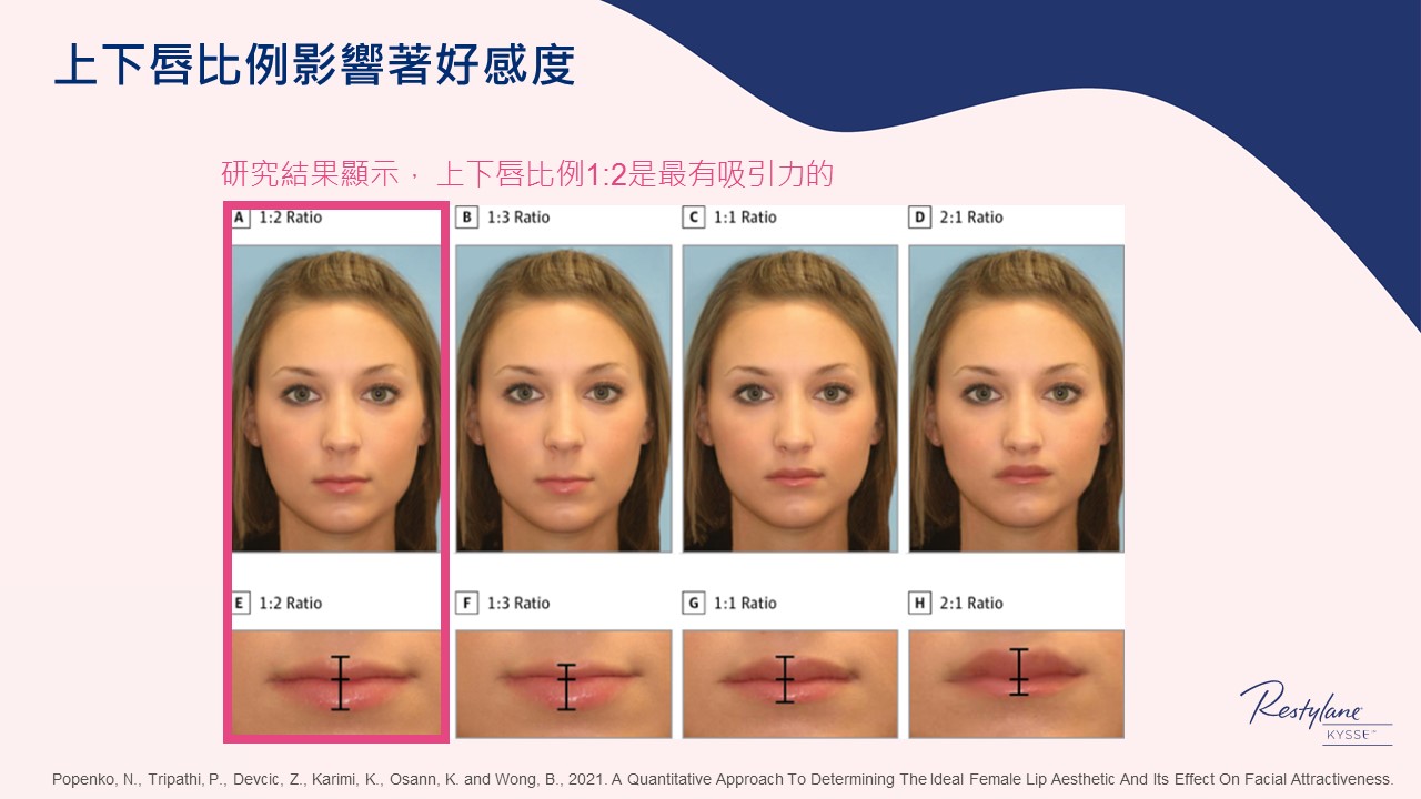 女神Kysse-漾唇K劑型