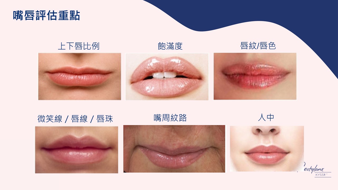 女神Kysse-漾唇K劑型