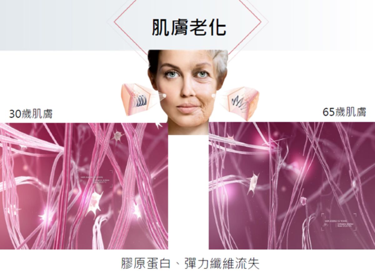 LPG Cellu M6 Alliance 第十代法式纖體雕塑 LPG Cellu M6 Alliance 第十代法式纖體雕塑