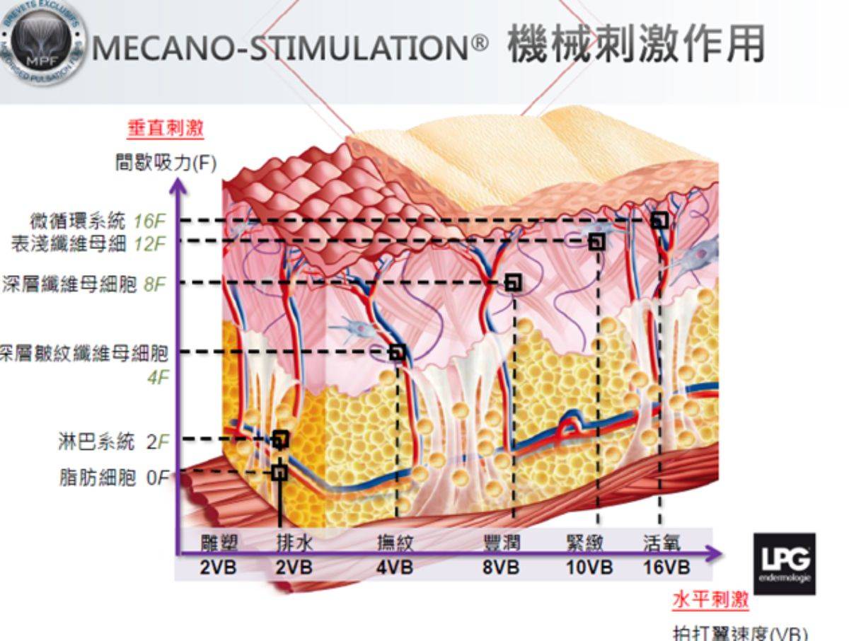 LPG Cellu M6 Alliance 第十代法式纖體雕塑 LPG Cellu M6 Alliance 第十代法式纖體雕塑