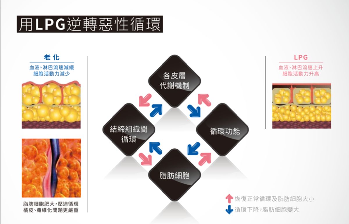 LPG Cellu M6 Alliance 第十代法式纖體雕塑 LPG Cellu M6 Alliance 第十代法式纖體雕塑